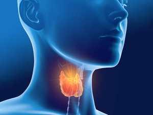 Hypothyroïdie poids : variations de poids et solutions