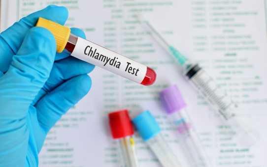 sexo - chlamydia