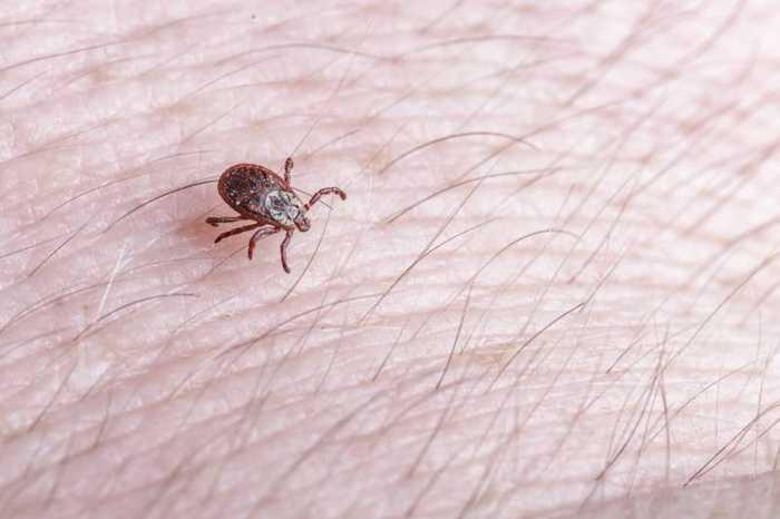 Maladie de Lyme : symptômes, traitement et diagnostic